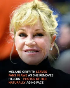 Melanie Griffith’s Transformation – Her Journey with Fillers to Her Look Now at 66